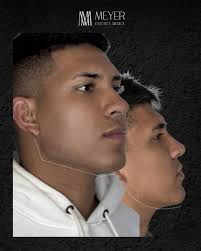 Dr. Mario Meyer (@meyer.esteticamedica) · Instagram photos and Reels