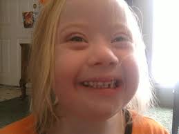 Down Syndrome in the Family