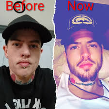 Hope ok to share it's not me just thought it might help p