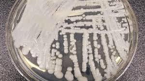 Image result for Buchnera candida