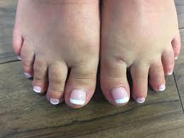 Unfollow acrylic toe nail to stop getting updates on your ebay feed. Before And After Acrylic Toes 20 Coco Tanning Hair And Beauty Facebook