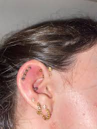 Nose Piercing Granuloma - Any Advice? And There'S A Bloody Photo | Mumsnet