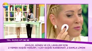 Sivilce Gunes Ve Cil Lekeleri Icin Formul Youtube
