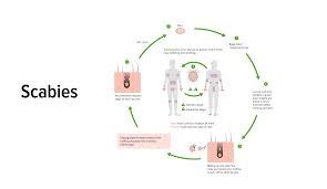 Image result for Sarcoptes scabiei life cycle