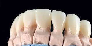 Ceramic Zirconia Crown: The Perfect Blend of Strength and Beauty in Dental Restorations - Topzir