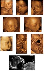 Sep 29, 2015 · below, you will find the average cost for the most common ultrasound exams. Perinatal Care High Risk Pregnancies St Luke S Women S Health