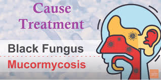 Fungal diseases are responsible for an increasing burden on healthcare systems. Black Fungus Disease Infection Symptoms Fungal Cause Treatment