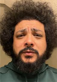 Natural Hair Loss Treatment in Alabama Bibb Brent