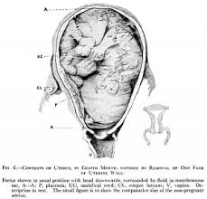 During pregnancy, the enlarged uterus results in elongation of the abdominal muscles and separation of the linea alba. Bgda Practical 12 Third Trimester Embryology