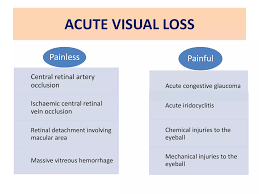 Image result for Acute Vision Loss