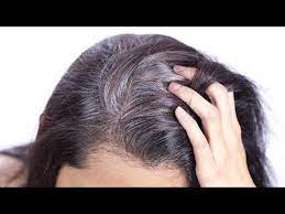 Here S An Amazing Home Remedy That Will Help You Reverse Your Hair Graying And Turn Them Black Again And Reverse Gray Hair Grey White Hair Black And Grey Hair