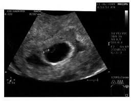 But in that short time, you will learn how to use the very common english expression how. How Long Does It Take To Get Your Dating Scan Nuchal Translucency Scan Pregnancy Birth And Baby How Long Do You Get To Know Someone Before Dating Having Crush On