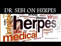 Dr Sebi The Man Who Cures All Dr Sebis Herpes Cure