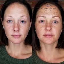 COMPLEXIONS By Jade Engler