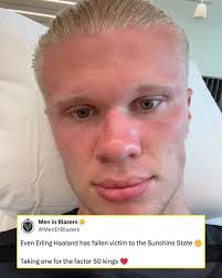 Florida sun so strong, even the robot gets sunburnt.