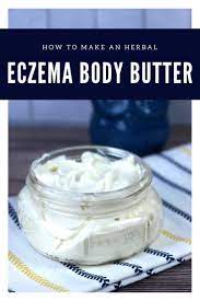 Shea butter has been known as a miracle cream to help people heal eczema. Homemade Eczema Body Butter With Aloe Vera Beautyproductrecipes How To Make A Whipped Body But Homemade Body Butter Diy Body Butter Body Butter Recipe Whipped