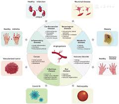 Image result for Angiogenesis