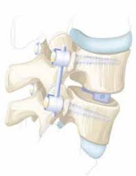 We did not find results for: Ruckenschmerzen Schulthess Klinik