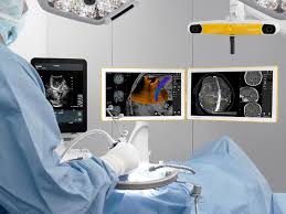 We are committed to being the most affordable ultrasound provider in the waikato. Intraoperative Ultrasound Brainlab