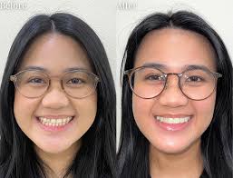 Dentist in Henderson, NV