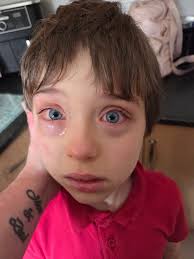 Hello 👋🏽 my son has been doing this with his eyes the past couple of  weeks. Our summer slowed down a bit after 4th of July, he hasn't been as  busy, so