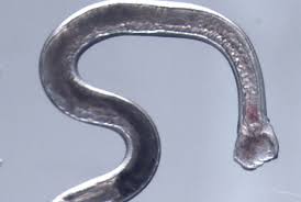 Image result for Hookworm