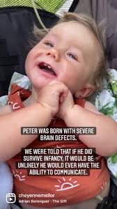 #perfectpeter #peterwinston #braindefects #babysigning #signlanguage  #specialneeds #disabilities #tuba1a #tubulinopathy #cerebralpalsy