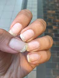Scrape the shellac polish off. Shellac Removal Beauty Nails Beauty Touch