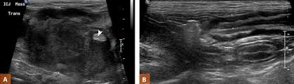 What skin tumors are common in dogs and cats? Ultrasonography Of The Gastrointestinal Tract Ileum Cecum Colon Today S Veterinary Practice