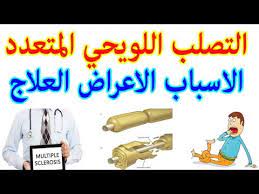 كيف يسبب مرض التصلب اللويحي تقلب المزاج ؟ بالإضافة إلى الشعور بالحزن والمشاعر العاطفية المختلفة بسبب العوامل الخارجية في البيئة من حولك، يمكن لمرض التصلب. Ø§Ù„ØªØµÙ„Ø¨ Ø§Ù„Ù„ÙˆÙŠØ­ÙŠ Ø§Ù„Ù…ØªØ¹Ø¯Ø¯ Ù…Ø§Ø°Ø§ ØªØ¹Ø±Ù Ø¹Ù†Ø© Youtube
