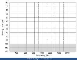Image result for Whispered Voice Testing