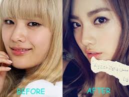 After School Nana Plastic Surgery Before And After Picture Skin Care Acne Plastic Surgery Proper Skin Care