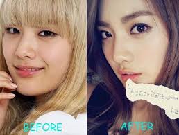 South korean singer and actress. After School Nana Plastic Surgery Before And After Picture Skin Care Techniques Skin Care Acne Proper Skin Care