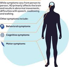 Image result for Chorea