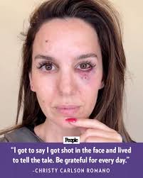 bit.ly/42NmV8D Christy Carlson Romano is recovering after being “shot in  the eye” by ”another party” during her husband's birthday celebration.