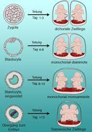 Entwicklung Zwillinge Im 1 Monat Babywelten Ch