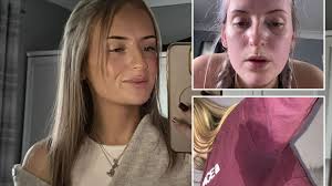 I sweat 3 litres a DAY