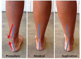 Pronation And Overpronation For Walking And Running Pronation Overpronation Kinesiology Taping