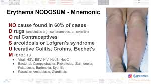 Image result for erythema nodosum