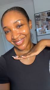 Super in love with my results from my face peel at @hello.perfect_ @onyeeka  thank youuu🥰🥰😍, #Skin #glowing #glowingskin #bestskinclinic #beauty  #skincare #CapCut