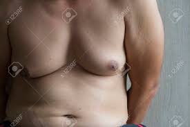 男性おっぱいデブ男の腹の脂肪の写真素材・画像素材 Image 81321497
