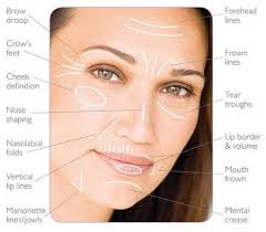 are you a sinker, sagger or wrinkler