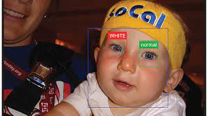 It also can go to your eyes from. An App That Can Catch Early Signs Of Eye Disease In A Flash Wamu
