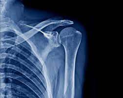 Image result for Shoulder Imaging