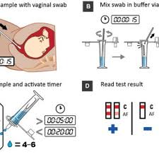 Image result for AmniSure ROM Test