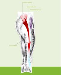 Arthritis is the most common cause of hip pain when sitting. Greater Trochanteric Pain Syndrome Physiopedia