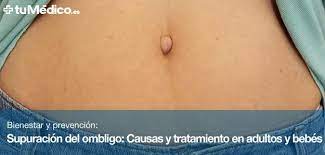 Supuracion Del Ombligo Causas Y Tratamiento En Adultos Y Bebes