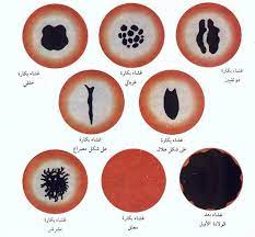 كيف اعرف اني مازلت عذراء دون الذهاب الى الطبيب الموقع المثالي