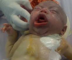 The Pan African Medical Journal Image Quiz