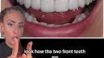 This might be the most stunning smile makeovers we have ...